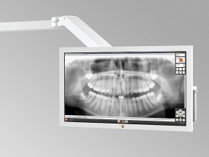 Dentaleinheit mit HD Monitor